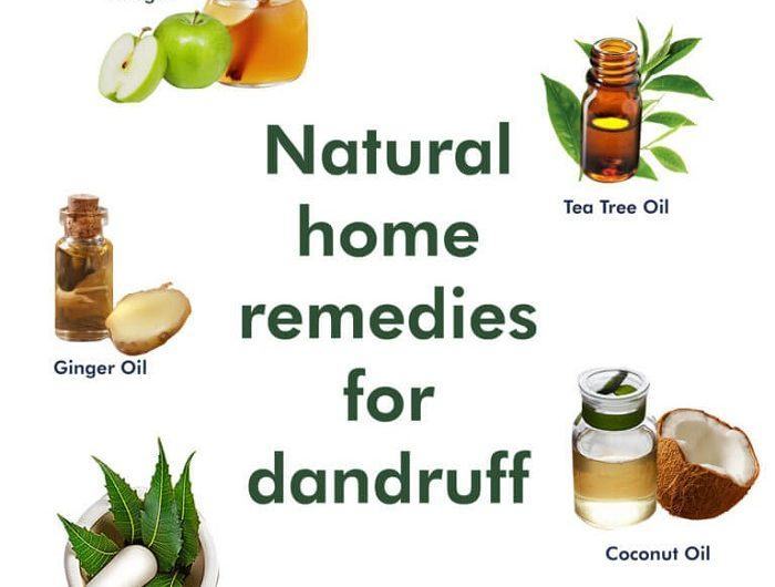 5 ways to treat dandruff with ingredients available at home