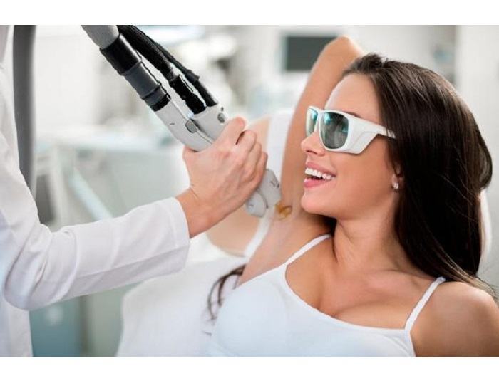 What is diode laser hair removal?